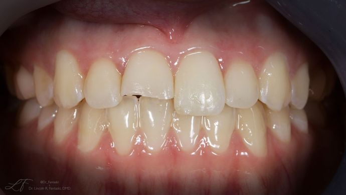 before cosmetic dentistry